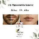 LipRevive: Lipcare balm